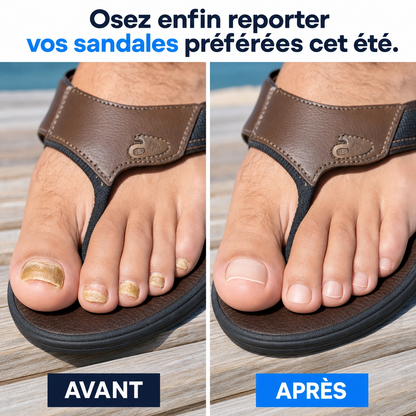 Bellia's -Patchs Réparateurs pour de Plus Beaux Ongles de Pieds